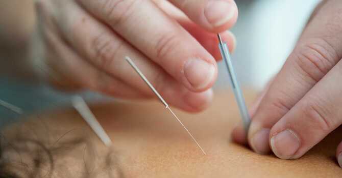 Dry Needling